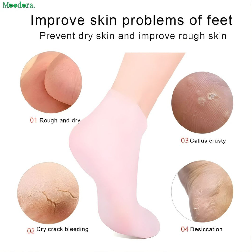 Moodora Silicone Gloves & Silicone Socks Combo – Soft Skin Care Moisturizing Set