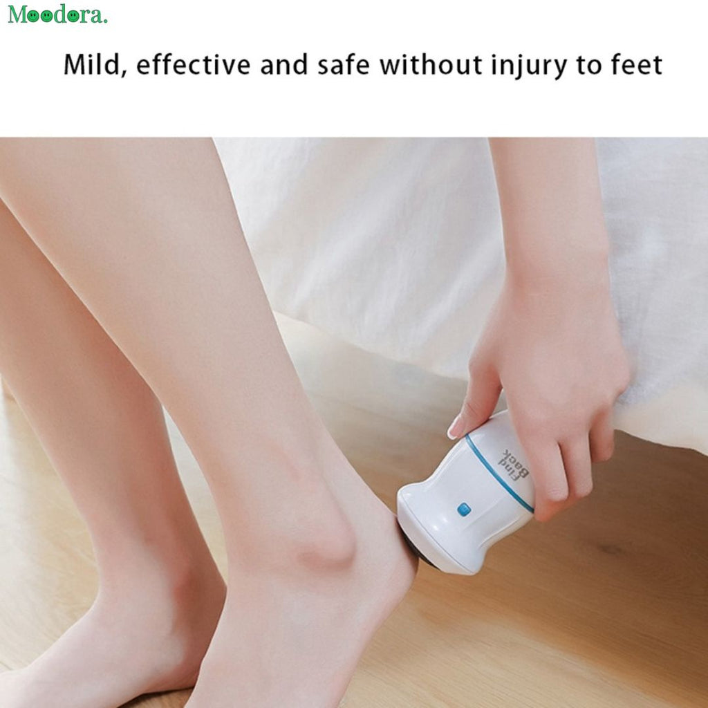 Moodora Electric Callus Remover with Built-In Vacuum – Rechargeable Foot Grinder for Smooth Heels