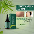 Moodora Markaway Stretch Mark Serum – Herbal Skin Repair Elasticity Formula (30ml)