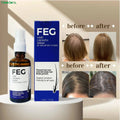 Moodora FEG Plus Hair Growth Spray 60ML – Anti Hair Fall & Follicle Support