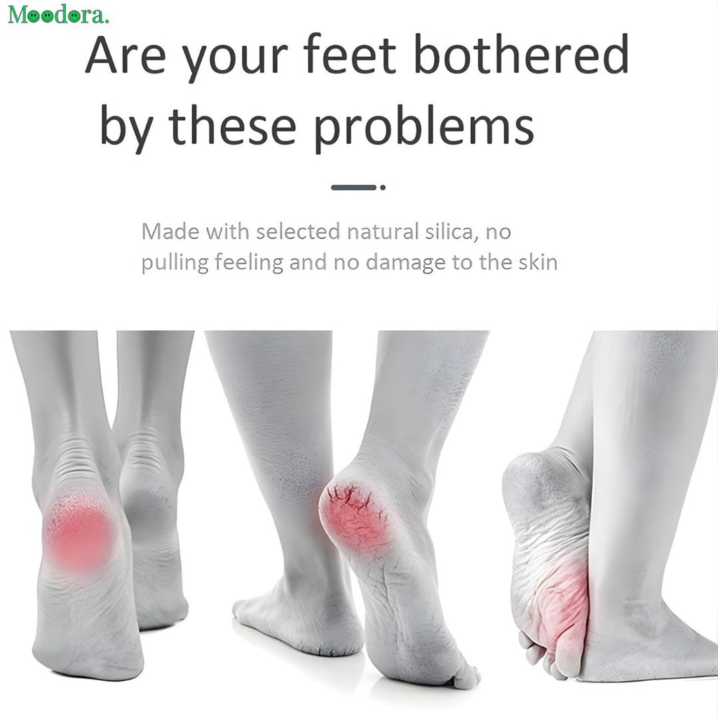 Moodora Electric Callus Remover with Built-In Vacuum – Rechargeable Foot Grinder for Smooth Heels