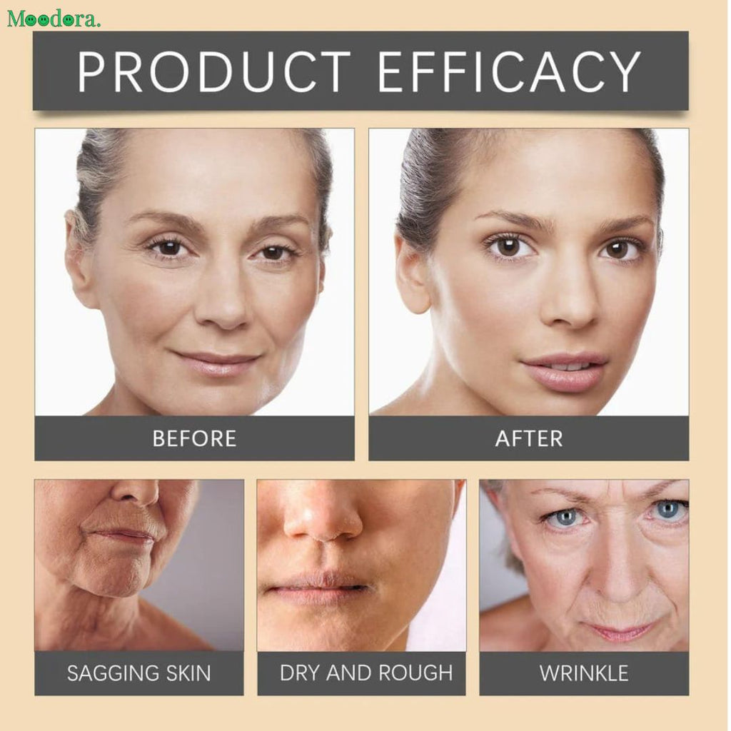 Moodora Botox Anti-Wrinkle Cream – Youthful Glow & Skin Firming (20g)