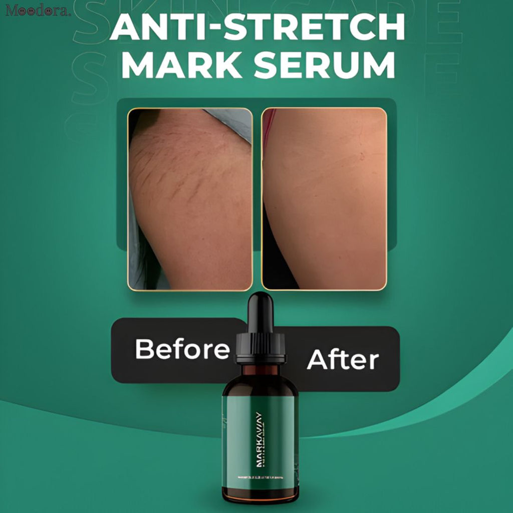 Moodora Markaway Stretch Mark Serum – Herbal Skin Repair Elasticity Formula (30ml)